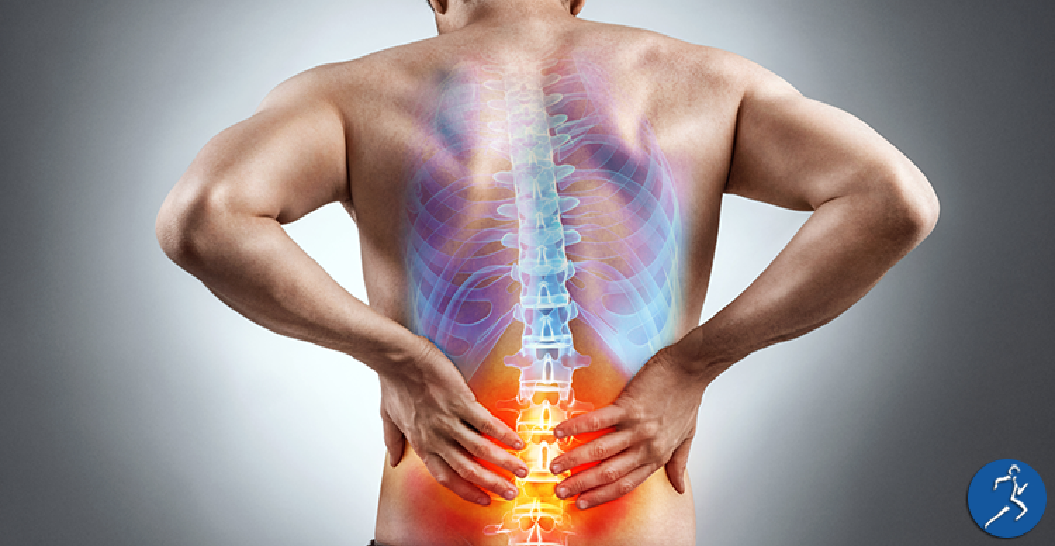 Does Physical Therapy Help with Sciatica?