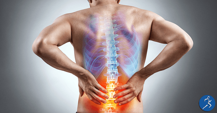 Does Physical Therapy Help with Sciatica? featured image