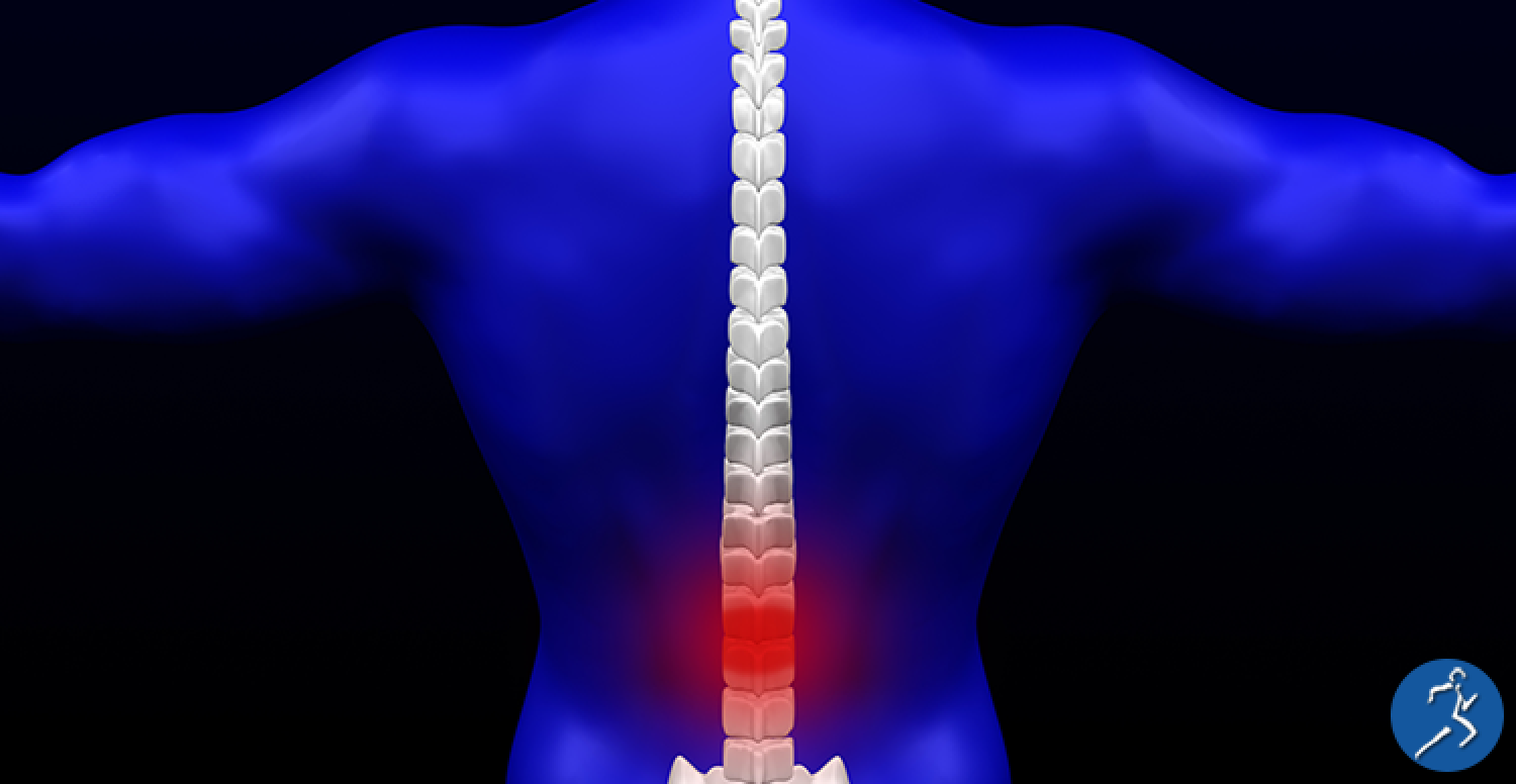 What is Spinal Stenosis?