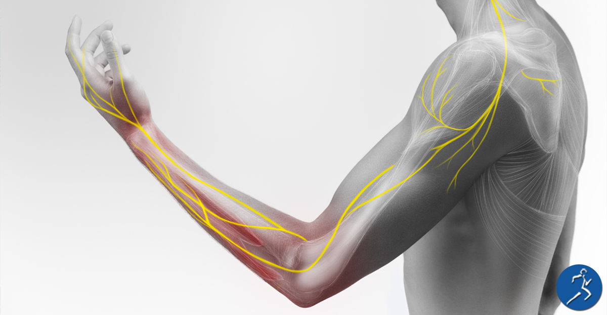 Introduction To Nerve Pain - Kinetic Physical Therapy